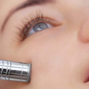 Diamond Microdermabrasion